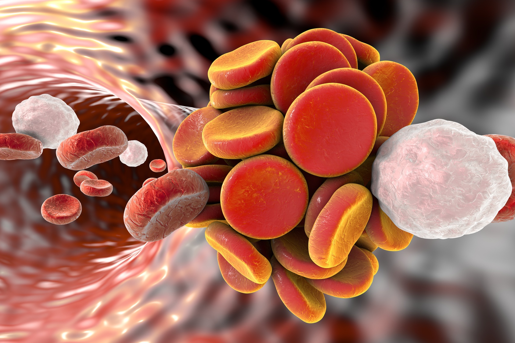 Anticoagulation