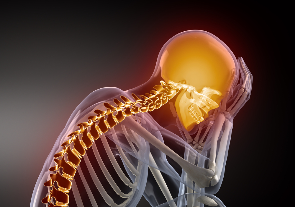Legal Options for Brain Bleed Victims