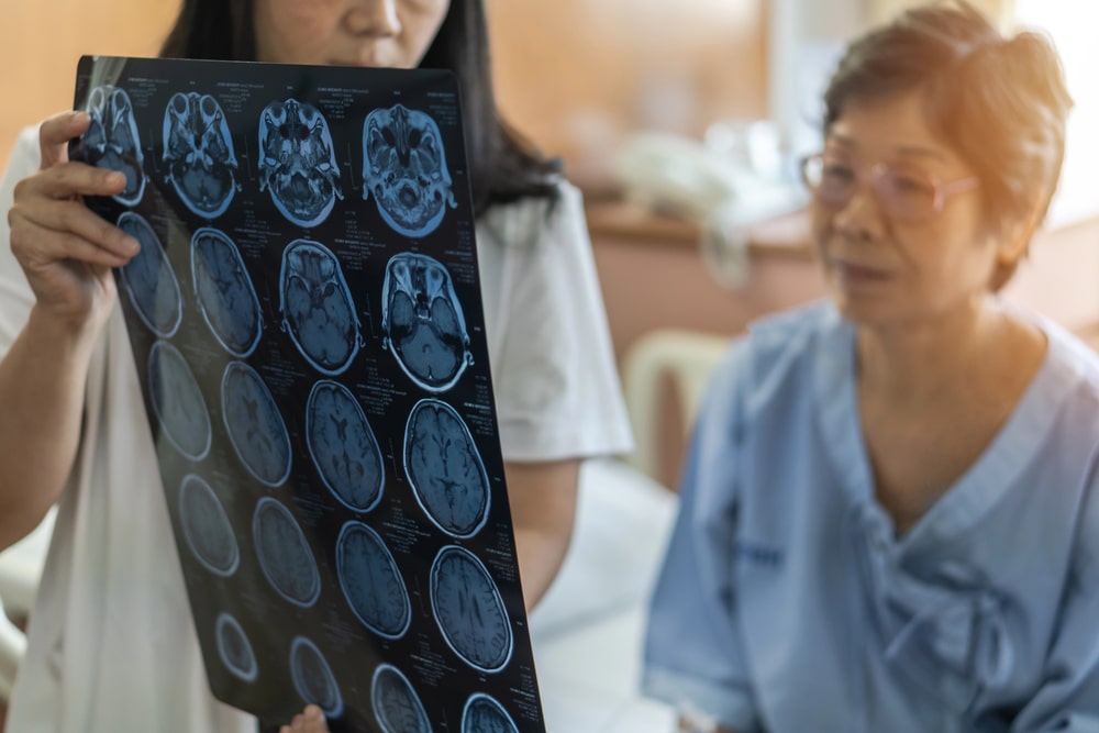 brain injury lawyer in Cleveland