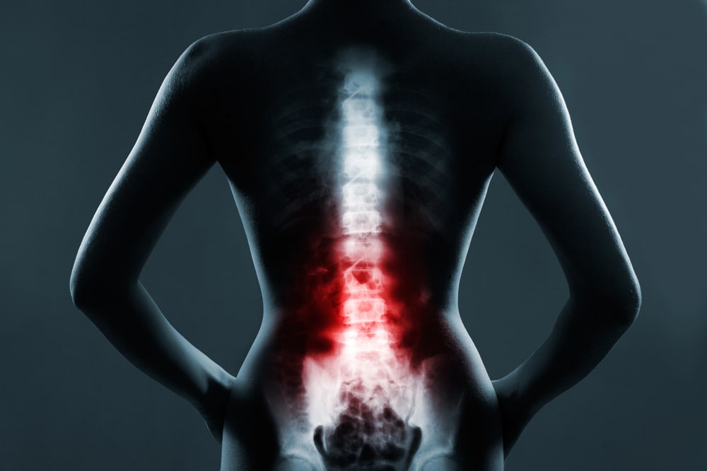 spinal cord injury lawyer Cleveland, OH
