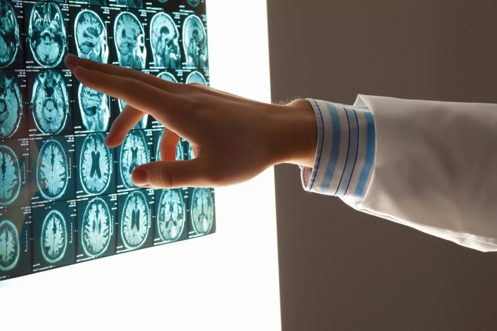 Brain Injury Lawyer Cleveland, OH