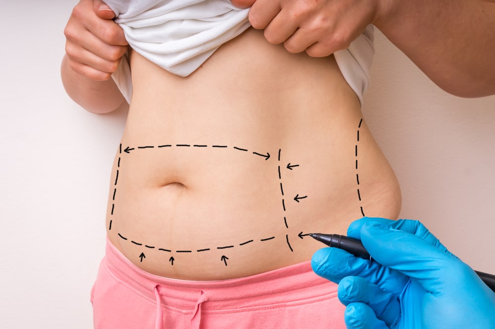 surgical malpractice lawyer Cleveland, OH
